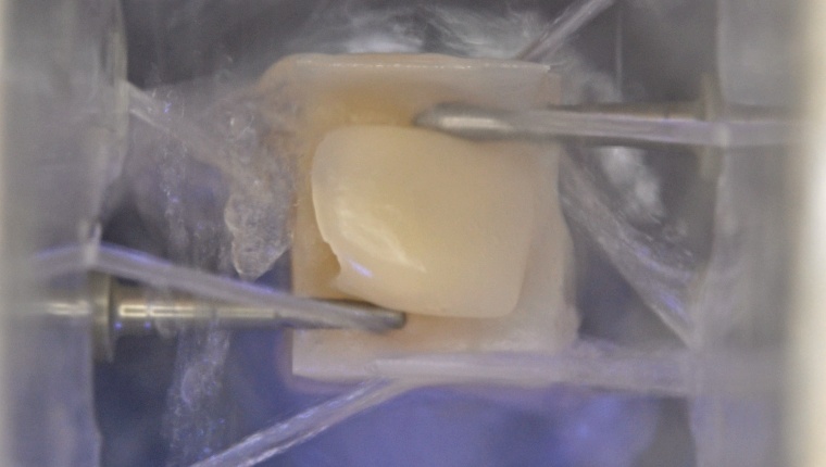 Korunky na počkání - CEREC