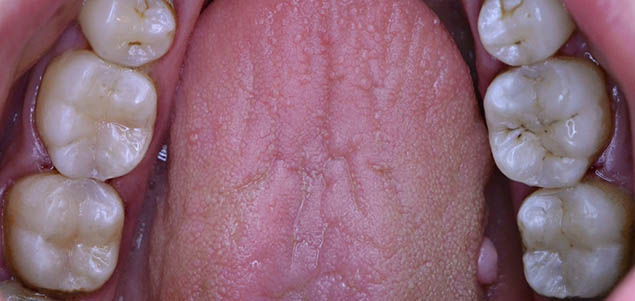 Nové bílé výplně Nové bílé výplně