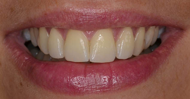 Po ošetření Po ošetření