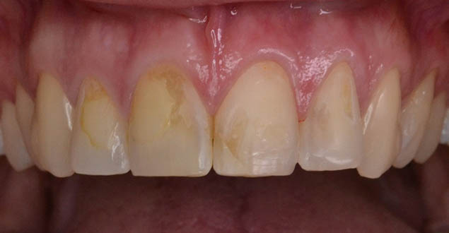 Před ošetřením Před ošetřením